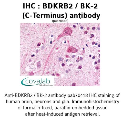 BDKRB2 / BK-2 (C-Terminus) antibody