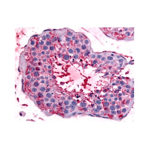 BEST2 / Bestrophin-2 (Internal) antibody