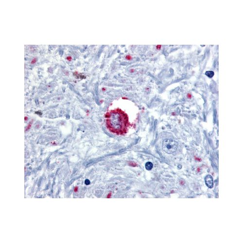 BRS3 (C-Terminus) antibody