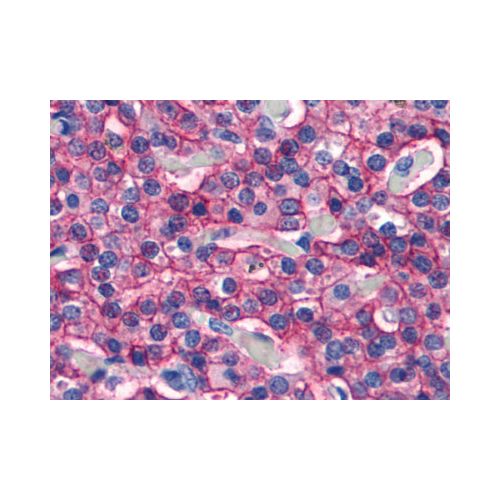 Calcium Sensing Receptor (N-Terminus) antibody