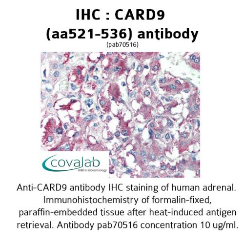 CARD9 (aa521-536) antibody