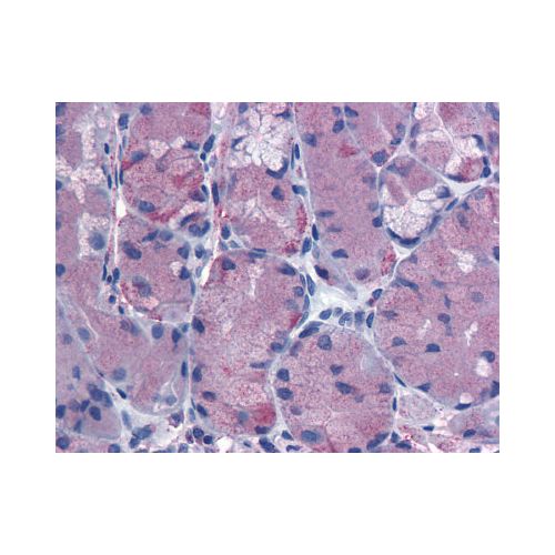 CCKBR (Extracellular Domain) antibody