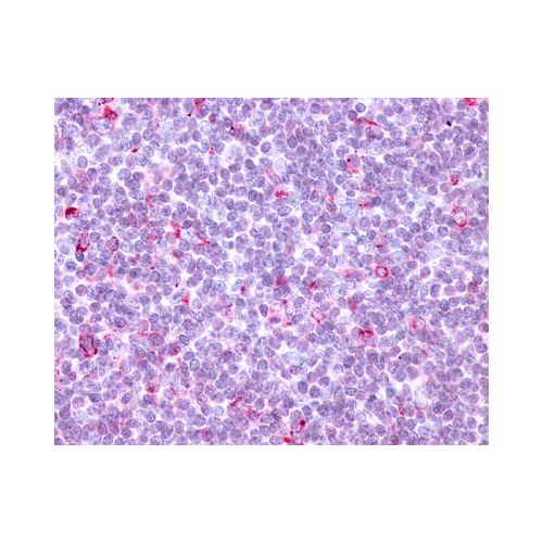CCR10 (C-Terminus) antibody