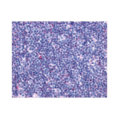 CCR10 (Extracellular Domain) antibody