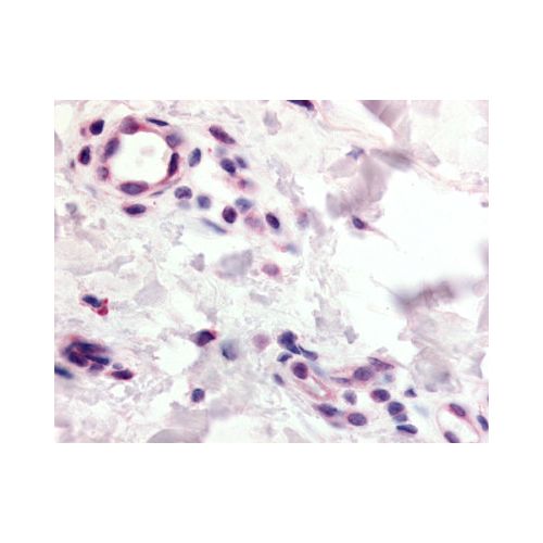 CCR10 (N-Terminus) antibody
