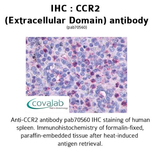 CCR2 (Extracellular Domain) antibody