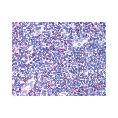 CCR4 (Extracellular Domain) antibody