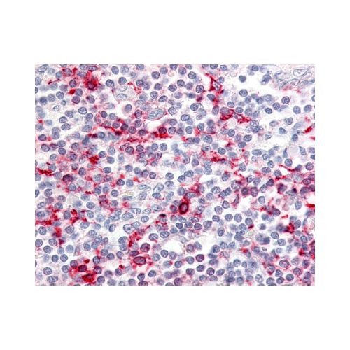 CCR6 (C-Terminus) antibody