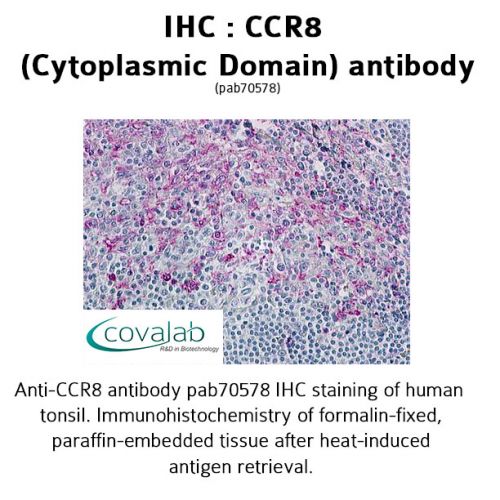 CCR8 (Cytoplasmic Domain) antibody