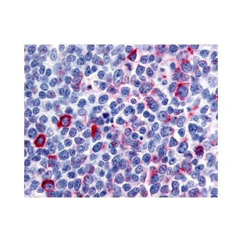CCR8 (N-Terminus) antibody