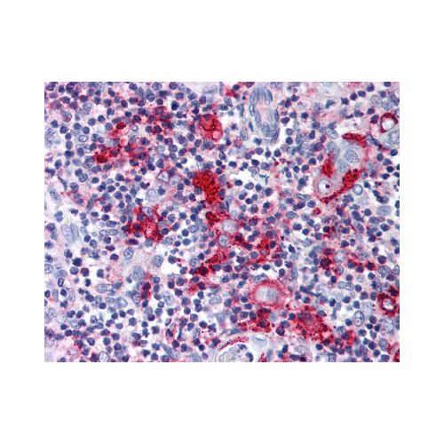 CCR9 (Extracellular Domain) antibody