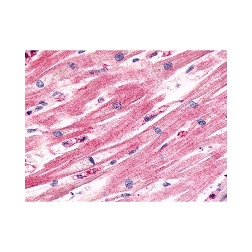 CCRL1 (Cytoplasmic Domain) antibody