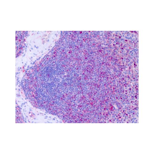CCRL1 (Cytoplasmic Domain) antibody