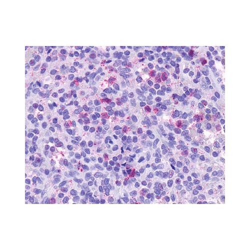 CCRL2 (Cytoplasmic Domain) antibody