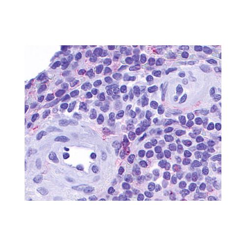 CCRL2 (Cytoplasmic Domain) antibody