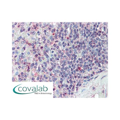 CD70 (N-Terminus) antibody