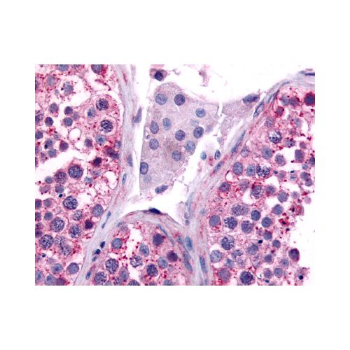 CDC7 (Kinase Domain) antibody
