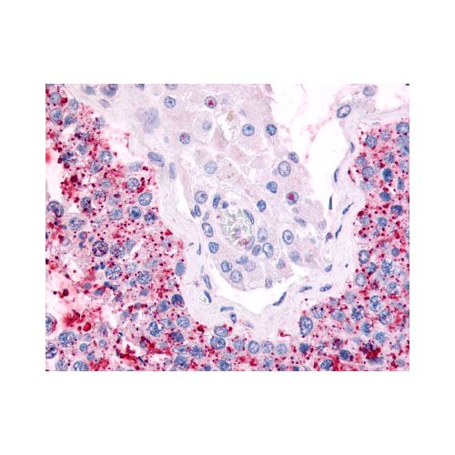 CDC7 (Kinase Domain) antibody