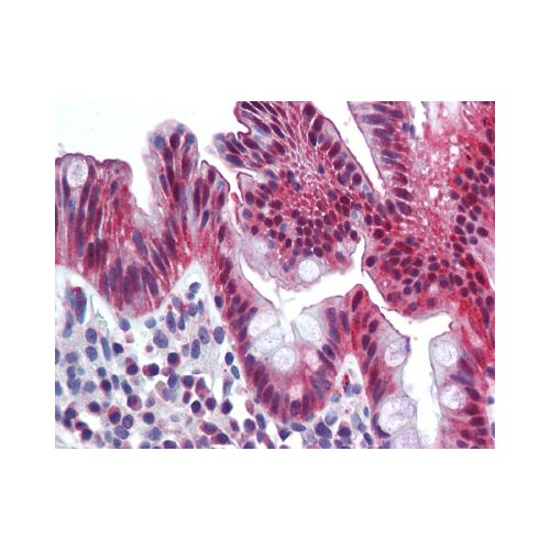 CEACAM1 (Internal) antibody