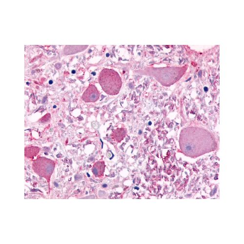 CELSR1 (N-Terminus) antibody