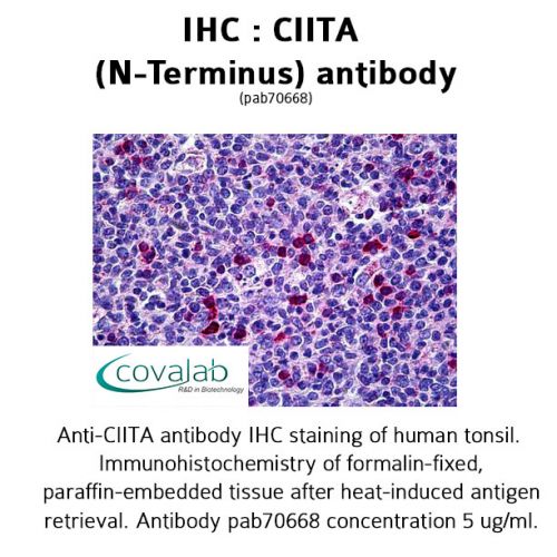 CIITA (N-Terminus) antibody