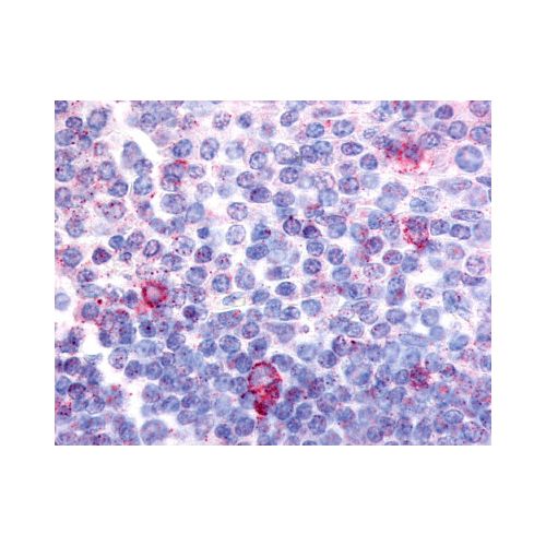 CNR2 / CB2 (N-Terminus) antibody