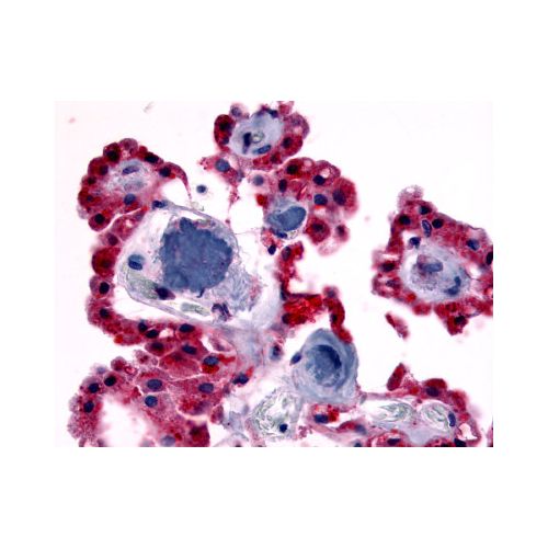 CRHR2 (Extracellular Domain) antibody