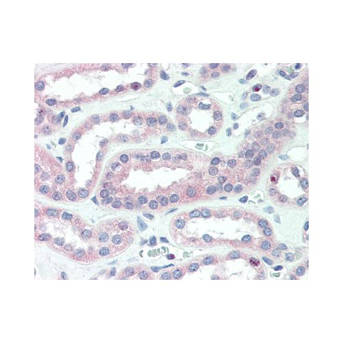 CRLF2 (Internal) antibody