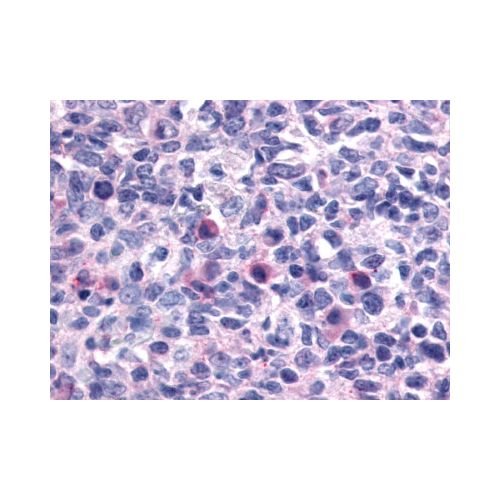 CXCR1 (N-Terminus) antibody