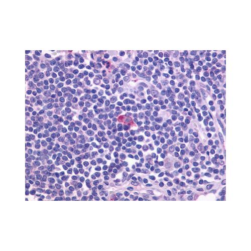 CXCR5 (Cytoplasmic Domain) antibody