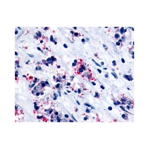 CYSLTR1 / CYSLT1 (C-Terminus) antibody