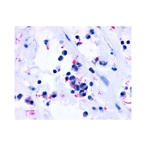 CYSLTR1 / CYSLT1 (Extracellular Domain) antibody