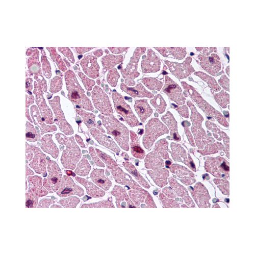CYSLTR2 / CYSLT2 (C-Terminus) antibody