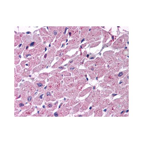 CYSLTR2 / CYSLT2 (Extracellular Domain) antibody