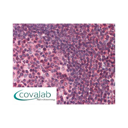 DAPK3 (Internal) antibody