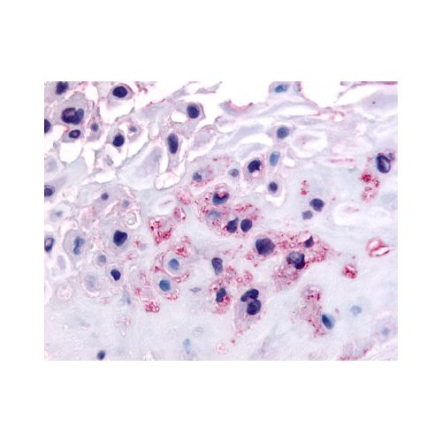 DDR1 / MCK10 (C-Terminus) antibody
