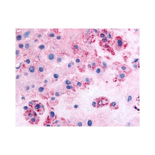 DDR1 / MCK10 (Internal) antibody