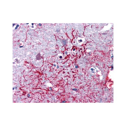 DHX58 (Internal) antibody