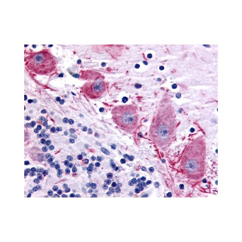 DPP10 (Extracellular Domain) antibody