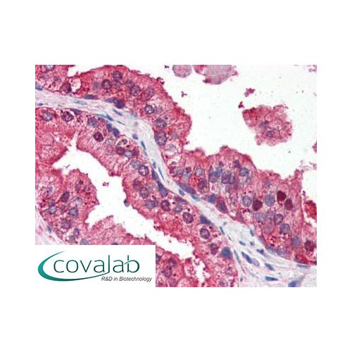 IHC : DRAM1 / DRAM (N-Terminus) antibody<br/>(pab70807)<br/>Anti-DRAM1 / DRAM antibody IHC staining of human prostate. Immunohistochemistry of formalin-fixed, paraffin-embedded tissue after heat-induced antigen retrieval. Antibody pab70807 concentration 3