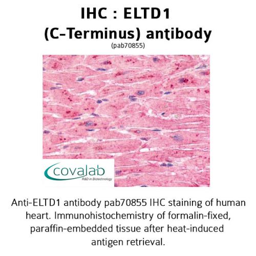 ELTD1 (C-Terminus) antibody