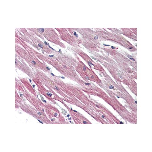 EPHX2 (C-Terminus) antibody