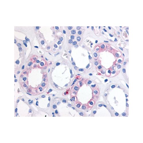 EPHX2 (Internal) antibody