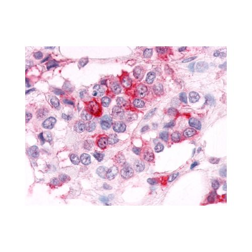 ESRRA (Ligand-binding Domain) antibody