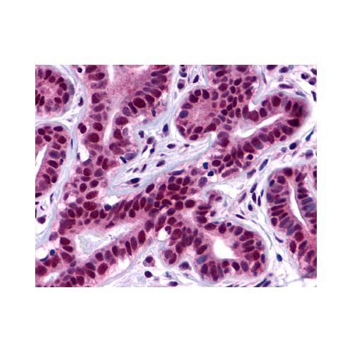 FAK (Internal) antibody