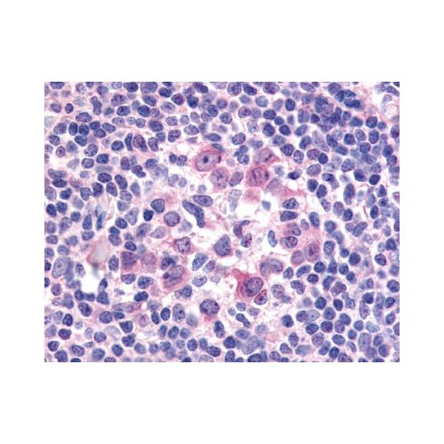 FLT3 / CD135 (C-Terminus) antibody