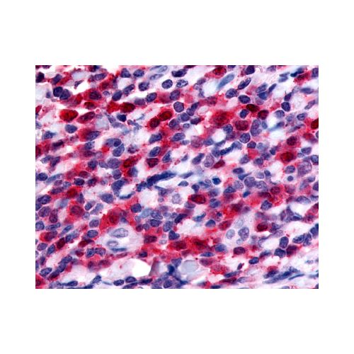 FLT3 / CD135 (Internal) antibody