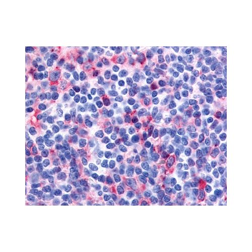 FLT3 / CD135 (N-Terminus) antibody