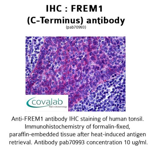 FREM1 (C-Terminus) antibody