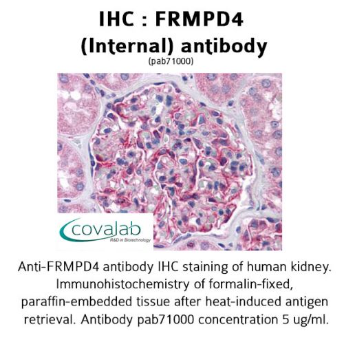 FRMPD4 (Internal) antibody